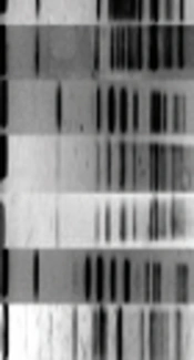 Cluster Analysis and Genetic Characterization of <i>Enterobacter cloacae</i> Complex from Blood Cultures
