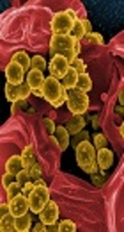 Molecular Epidemiology of Panton-Valentine Leukocidin Harboring Hospital-Associated Methicillin-Resistant <i>Staphylococcus aureus</i> in Septicemic Children, Northeastern Iran, Bojnurd