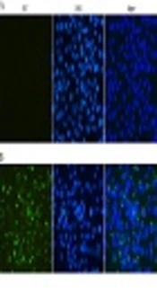 Efficient Capture and Detection of Zika Virion by Polyclonal Antibody Against Prokaryotic Recombinant Envelope Protein
