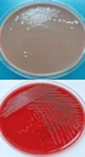 The First Report of Cerebral Nocardiosis Caused by Nocardia terpenica Together With Exiguobacterium profundum Bacteremia