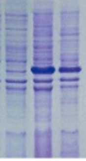 Antibiotic Characterization of Acinetobacter baumannii Isolated from Clinical Samples and Production of Recombinant OmpA from Resistant Strains