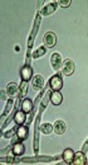 Cover image of the article: Novel Formulated Zinc Oxide Nanoparticles Reduce Hwp1 Gene Expression Involved in Biofilm Formation in Candida albicans with Minimum Cytotoxicity Effect on Human Cells