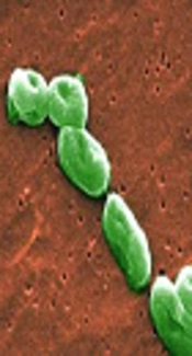 The Complexity of the Identification of <i>Burkholderia cepacia</i> Strain Which Caused Septicemia