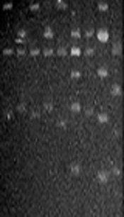 A Predominant Cariogenic Genotype of Streptococcus mutans in Schoolchildren of Mexico City: A Follow-Up Study