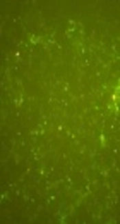Investigating <i>Chlamydia trachomatis</i> and Genital <i>Mycoplasma</i> Prevalence and Apoptosis Markers in Infertile and Fertile Couples
