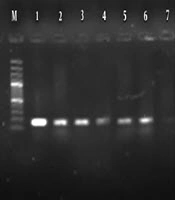 Determination Antimicrobial Resistance Profile and Prevalence of Class 1 and 2 Integron Resistance Gene Cassettes in Pseudomonas aeruginosa Strains Isolated from Hospitalized Patients in Markazi Province, Iran