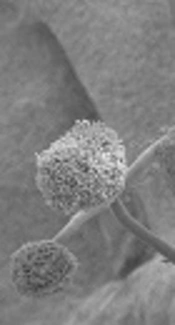 Clinical and Non-Clinical Characteristics of Pulmonary Aspergillosis in Non-Neutropenic Patients
