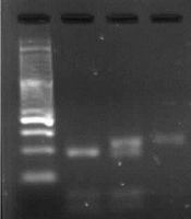 IL-10 -1082 A/G (rs1800896) Polymorphism is Effective in Clearing Hepatitis B Virus Infection