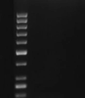 Antibiotic Resistance Among Klebsiella pneumoniae, Molecular Detection and Expression Level of blaKPC and blaGES Genes by Real-Time PCR