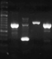 The Study of Mutation in LasR and PqsR Genes in Extremely Drug Resistant and Multidrug Resistant Strains of Pseudomonas aeruginosa from Burn Wound Infection