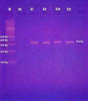Detection of mcr-1 Gene in Extended-Spectrum β-Lactamase-Producing Klebsiella pneumoniae From Human Urine Samples in Pakistan