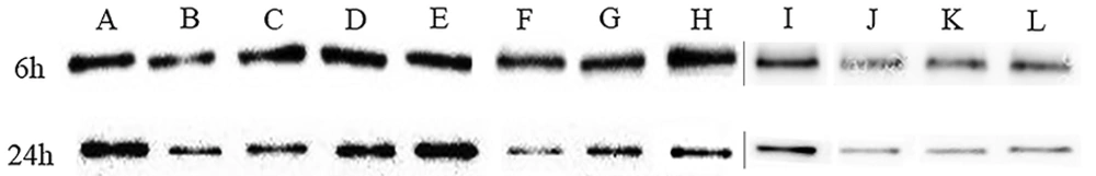 Repressive effects of SH in combination with erythromycin on the production of IcaA of <i>Staphylococcus epidermidis</i>. The production of IcaA was monitored in response to SH in combination with erythromycin treatments by Western blotting assay. Distinct drug concentrations of treatments representing different bands were as bellow: negative control group (without any drug), A, 1 × MIC SH mL; B, 1/2 × MIC SH mL<sup>-1</sup>; C, 1/4 × MIC SH mL<sup>-1</sup>; D, 1/8 × MIC SH; E, 1×MIC erythromycin; F, 1/2 × MIC erythromycin; G, 1/4 × MIC erythromycin; H, 1/8 × MIC erythromycin; I, 1/2 × MIC SH and 1/2 × MIC erythromycin; J, 1/4 × MIC SH and 1/4 × MIC erythromycin; K, 1/8 × MIC SH and 1/8 × MIC erythromycin; L, the gels of A-H and I-L were grouped together. The production of IcaA in different groups was detected at 6 h and 24 h after drug treatment. Repressive effects of SH in combination with erythromycin on the production of IcaA of <i>Staphylococcus epidermidis</i>. The production of IcaA was monitored in response to SH in combination with erythromycin treatments by Western blotting assay. Distinct drug concentrations of treatments representing different bands were as bellow: negative control group (without any drug), A, 1 × MIC SH mL; B, 1/2 × MIC SH mL<sup>-1</sup>; C, 1/4 × MIC SH mL<sup>-1</sup>; D, 1/8 × MIC SH; E, 1×MIC erythromycin; F, 1/2 × MIC erythromycin; G, 1/4 × MIC erythromycin; H, 1/8 × MIC erythromycin; I, 1/2 × MIC SH and 1/2 × MIC erythromycin; J, 1/4 × MIC SH and 1/4 × MIC erythromycin; K, 1/8 × MIC SH and 1/8 × MIC erythromycin; L, the gels of A-H and I-L were grouped together. The production of IcaA in different groups was detected at 6 h and 24 h after drug treatment.