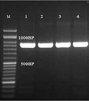 Ocular Fungi: Molecular Identification and Antifungal Susceptibility Pattern to Azoles