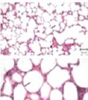 Cover image of the article: The Protective Effects of Nebulized Nano-Curcumin Against Bleomycin-Induced Pulmonary Fibrosis in Rats
