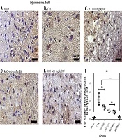 Cover image of the article: Red Ginger Oil Affects COX-2 and NMDAR Expression During Inflammatory- or Neuropathy-Induced Chronic Pain in Mice