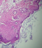 Jundishapur J Nat Pharm Prod