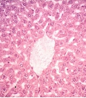 Zingerone Attenuates Methotrexate-Induced Hepatotoxicity in Rats