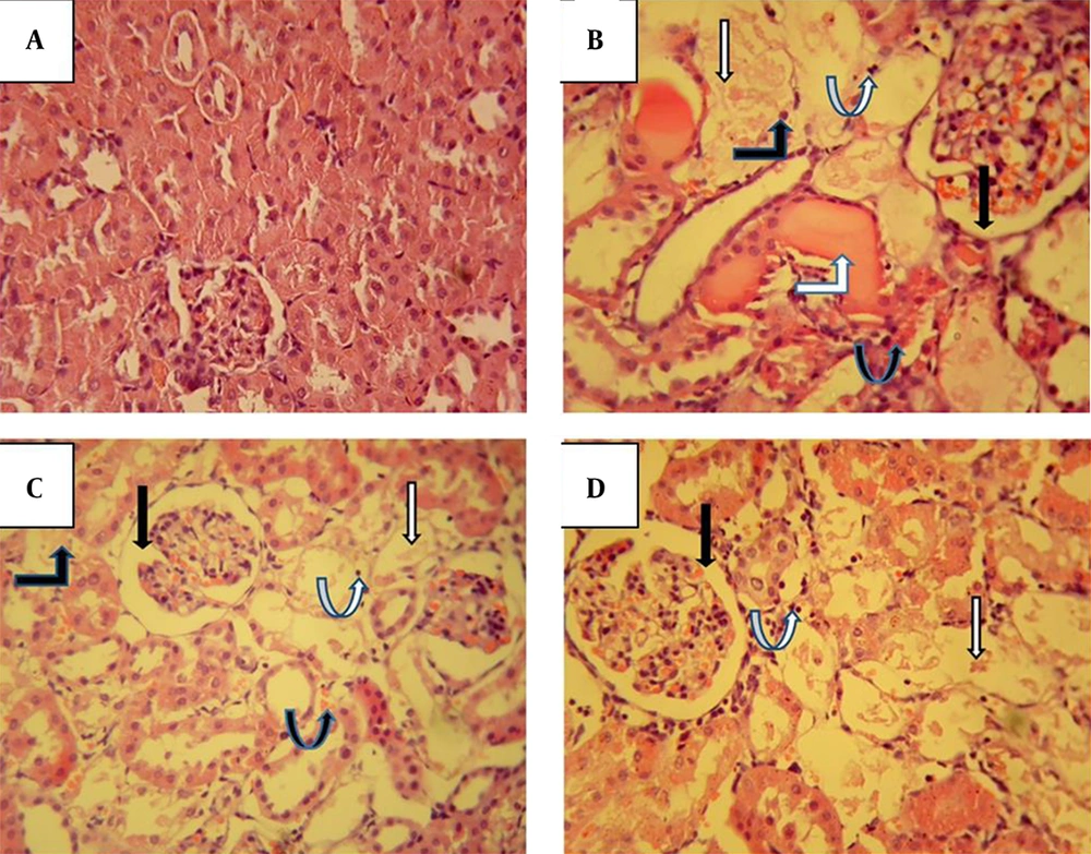 The effect of fucoidan on gentamicin-induced histopathological changes in the renal cortex stained with hematoxylin and eosin (× 400). Kidney photomicrograph in the control group shows interstitium; glomeruli and tubules are normal (A). Administration of 100 mg/kg/day gentamicin in the Gen group induced structural disturbances characterized by Bowman’s space enlargement (black arrow), severe proximal tubular injury (white arrow), acute tubular necrosis (black bent-up arrow), intratubular cast (white bent-up arrow), inflammatory cells (white curved-up arrow), and vascular congestion (black curved-up arrow) (B). Fucoidan treatment (C and D), especially at a dose of 50 mg/kg (Gen+F50), partially attenuated the glomerular and tubular damages. The effect of fucoidan on gentamicin-induced histopathological changes in the renal cortex stained with hematoxylin and eosin (× 400). Kidney photomicrograph in the control group shows interstitium; glomeruli and tubules are normal (A). Administration of 100 mg/kg/day gentamicin in the Gen group induced structural disturbances characterized by Bowman’s space enlargement (black arrow), severe proximal tubular injury (white arrow), acute tubular necrosis (black bent-up arrow), intratubular cast (white bent-up arrow), inflammatory cells (white curved-up arrow), and vascular congestion (black curved-up arrow) (B). Fucoidan treatment (C and D), especially at a dose of 50 mg/kg (Gen+F50), partially attenuated the glomerular and tubular damages.