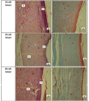 Evaluating the Effectiveness of Aqueous Extract of Persian Oak (Quercus castaneifolia C.A.Mey.) Fruit Hull on Dermal Wound Healing in the Rat Model