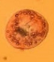Cover image of the article: Antiparasitic Effects and Cellular Mechanisms of Formononetin (a Natural Isoflavone) Against Hydatid Cyst Protoscoleces