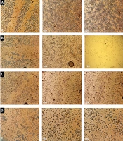Green Tea Catechin Potentiating Doxorubicine Effects against BE(2)C Neuroblastoma Cells In Vitro