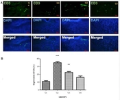 Electrospun PVA Nanofibers Loaded with Antimicrobial Herbal Extracts for Healing the Infectious Wound
