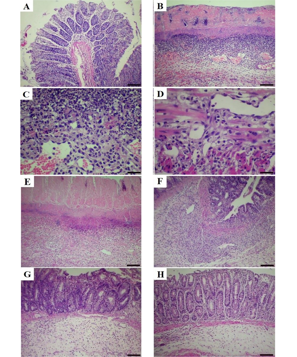 Histopathological lesion in the colon tissue of normal and acetic acid groups (hematoxylin-eosin (H&E) staining). A, normal group, normal architecture of colon tissue (scale bar = 150 µm); B, acetic acid group, focal ulceration, severe necrosis and crypt destruction in the mucosal layer (scale bar = 150 µm); C, acetic acid group, severe infiltration of mono- and polymorph nuclear cells in the submucosal layer (scale bar = 70 µm); D, necrosis of muscle tissue and infiltration of inflammatory cells in the muscularis layer (scale bar = 70 µm); E, <i>A. vulgaris</i> (50 mg/kg) group, moderate to severe crypt destruction and necrosis with moderate inflammation; F, <i>A. vulgaris</i> (100 mg/kg) group, moderate crypt destruction and necrosis with moderate inflammation; G, <i>A. vulgaris</i> (200 mg/kg) group, mild crypt destruction, and necrosis with mild inflammation; and H, sulfasalazine group, mild crypt destruction with minimal mucosal inflammation. Histopathological lesion in the colon tissue of normal and acetic acid groups (hematoxylin-eosin (H&E) staining). A, normal group, normal architecture of colon tissue (scale bar = 150 µm); B, acetic acid group, focal ulceration, severe necrosis and crypt destruction in the mucosal layer (scale bar = 150 µm); C, acetic acid group, severe infiltration of mono- and polymorph nuclear cells in the submucosal layer (scale bar = 70 µm); D, necrosis of muscle tissue and infiltration of inflammatory cells in the muscularis layer (scale bar = 70 µm); E, <i>A. vulgaris</i> (50 mg/kg) group, moderate to severe crypt destruction and necrosis with moderate inflammation; F, <i>A. vulgaris</i> (100 mg/kg) group, moderate crypt destruction and necrosis with moderate inflammation; G, <i>A. vulgaris</i> (200 mg/kg) group, mild crypt destruction, and necrosis with mild inflammation; and H, sulfasalazine group, mild crypt destruction with minimal mucosal inflammation.