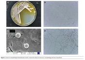 Screening, Identification, and Pigment Characteristics of Actinomycin D-Producing Actinomycetes from Purple Soil in the Sichuan Basin
