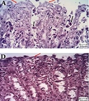 Gastroprotective Effects of Betanin Against Ethanol-induced Gastric Ulcer in Rats