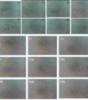 Cytotoxicity of Fractions of Dracontium spruceanum Chloroform Extract in MDA-MB-231 and MCF-7 Breast Cancer Cell Lines