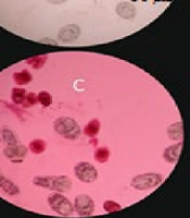 Unveiling Therapeutic Effects of Thymbra spicata L. on Cystic Echinococcosis