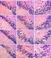 Cover image of the article: Anticholinesterase, Antioxidative and Neuroprotective Effects of Hydroethanolic Extracts of Guiera Senegalensis J. F. Gmel. Leaves on Scopolamine Induced Alzheimer’s Disease in Wistar Rat Models