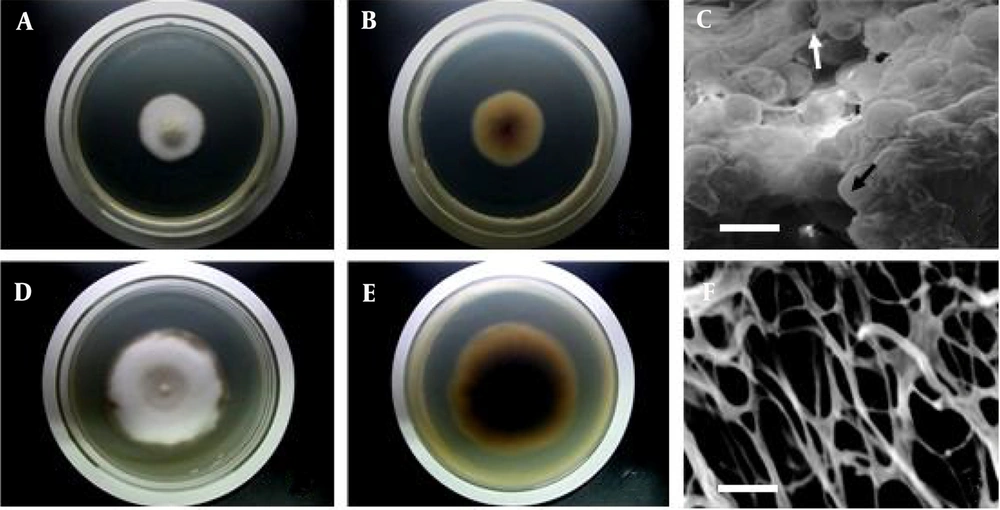 Colony morphological characteristics of TR21 and NU204. (A) and (D) show the front of TR21 and NU204 on PDA after 7 d, respectively. (B) and (E) show the back of TR21 and NU204 on PDA after 7 d, respectively. (C) shows the scanning electron microscope (SEM) micrograph of aggregated mycelium (white arrow) and round cleistothecium (black arrow) of TR21. (F) shows the SEM micrograph of aggregated mycelium of NU204. Scale Bar = 30 μm. Colony morphological characteristics of TR21 and NU204. (A) and (D) show the front of TR21 and NU204 on PDA after 7 d, respectively. (B) and (E) show the back of TR21 and NU204 on PDA after 7 d, respectively. (C) shows the scanning electron microscope (SEM) micrograph of aggregated mycelium (white arrow) and round cleistothecium (black arrow) of TR21. (F) shows the SEM micrograph of aggregated mycelium of NU204. Scale Bar = 30 μm.