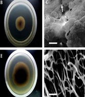 Induction of Tanshinone IIA Production in the Endophytic Fungus Emericella foeniculicola TR21 From Salvia miltiorrhiza Bunge