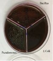Cover image of the article: Study One-Pot Synthesis of Nanoparticles Omeprazole-Silver and Omeprazole Sulfide-Silver and Their Antibacterial Properties