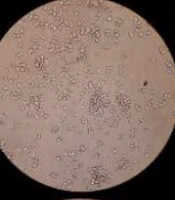 Isolation and Identification of Effective Probiotics on Staphylococcus epidermidis Strains Isolated from Urine Sample