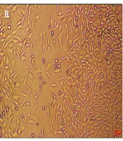 Down-Regulation of HOTAIR, SUZ12, and DNMT3A by Curcumin Nanoparticles in Glioblastoma