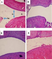 Fraxinus excelsior L. Hydromethanolic Extract Modulates Rheumatoid Arthritis Induced by Complete Freund’s Adjuvant in Rats Emphasizing Inflammatory and Antioxidant Pathways