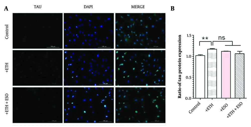 Assessment of TAU protein expression (non-physiologic form) in neural progenitor cells (NPCs): A, the figure depicts the TAU protein expression levels in NPCs, observed using the immunocytochemistry (ICC) technique at 10X magnification; B, illustrates the TAU protein expression results across various groups of NPCs (**P < 0.01; Abbreviation: NS, not significant). Assessment of TAU protein expression (non-physiologic form) in neural progenitor cells (NPCs): A, the figure depicts the TAU protein expression levels in NPCs, observed using the immunocytochemistry (ICC) technique at 10X magnification; B, illustrates the TAU protein expression results across various groups of NPCs (**P < 0.01; Abbreviation: NS, not significant).