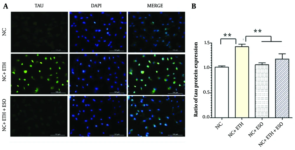 Assessment of TAU protein expression in neural cells (NCs): A, the figure illustrates the level of TAU protein expression in NCs, observed using the immunocytochemistry (ICC) technique at 10X magnification; B, presents the results of TAU protein expression in various groups of NCs (asterisks show significant differences among control and treated samples in each column; **P < 0.01). Assessment of TAU protein expression in neural cells (NCs): A, the figure illustrates the level of TAU protein expression in NCs, observed using the immunocytochemistry (ICC) technique at 10X magnification; B, presents the results of TAU protein expression in various groups of NCs (asterisks show significant differences among control and treated samples in each column; **P < 0.01).