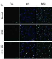 Neuroprotective Effects of Rosa damascena Essential Oil Against Ethanol-Induced Toxicity in Neural Progenitor Cells