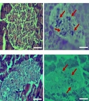 GABA and Astaxanthin Improve Markers of Streptozotocin-Induced Type 1 Diabetes in Rats: Additive Effects of Combination Therapy
