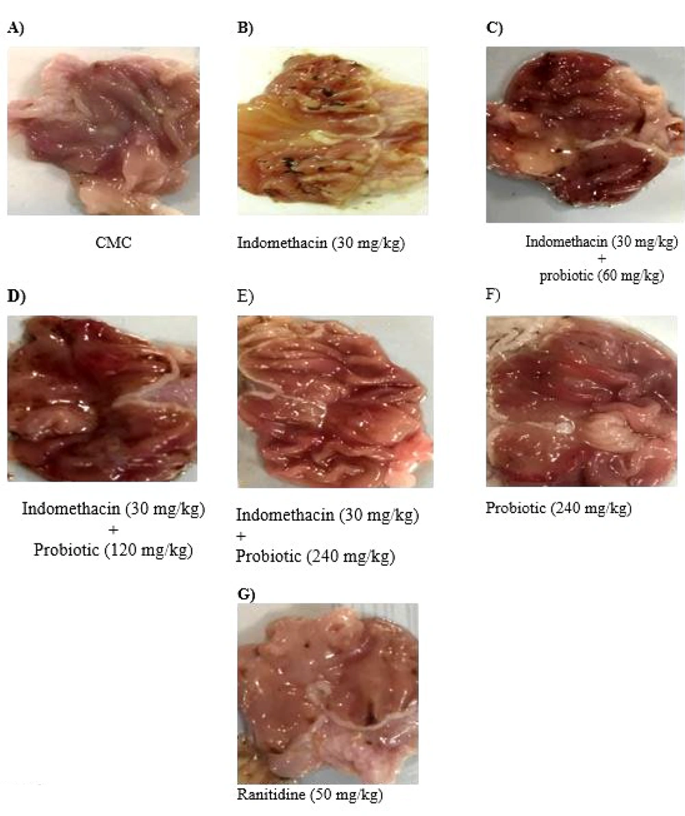 The gross appearance of gastric ulcers induced by Indomethacin(30 mg/kg) and protective effects of Powder Containing Probiotic Metabolites (60, 120, or 240 mg/kg). A, CMC; B, iandomethacin (30mg/kg); C, iandomethacin and pretreatment with 60 mg/kg Powder Containing Probiotic Metabolites; D, iandomethacin and pretreatment with 12o mg/kg Powder Containing Probiotic Metabolites; E, iandomethacin and Powder Containing Probiotic Metabolites (240mg/kg). F, powder Containing Probiotic Metabolites (240mg/kg); G, iandomethacin and ranitidine (50 mg/kg). The gross appearance of gastric ulcers induced by Indomethacin(30 mg/kg) and protective effects of Powder Containing Probiotic Metabolites (60, 120, or 240 mg/kg). A, CMC; B, iandomethacin (30mg/kg); C, iandomethacin and pretreatment with 60 mg/kg Powder Containing Probiotic Metabolites; D, iandomethacin and pretreatment with 12o mg/kg Powder Containing Probiotic Metabolites; E, iandomethacin and Powder Containing Probiotic Metabolites (240mg/kg). F, powder Containing Probiotic Metabolites (240mg/kg); G, iandomethacin and ranitidine (50 mg/kg).