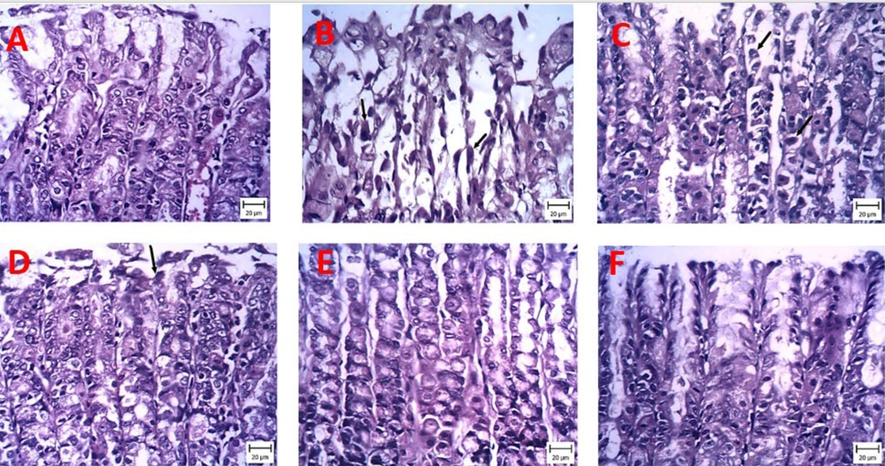 Representative pictures of stomach sections stained with hematoxylin and eosin (H&E) examined under a microscope. Protective effects of powder containing probiotic metabolites (60, 120, or 240 mg/kg) on histopathological changes of gastric tissue induced by indomethacin (hematoxylin and eosin staining, magnification × 200). A, carboxymethyl cellulose (CMC); B, iandomethacin (30 mg/kg); C, iandomethacin and pretreatment with 60 mg/kg powder containing probiotic metabolites, D, iandomethacin and pretreatment with 120 mg/kg powder containing probiotic metabolites; E, iandomethacin and powder containing probiotic metabolites (240mg/kg); F, iandomethacin and ranitidine (50 mg/kg). Representative pictures of stomach sections stained with hematoxylin and eosin (H&E) examined under a microscope. Protective effects of powder containing probiotic metabolites (60, 120, or 240 mg/kg) on histopathological changes of gastric tissue induced by indomethacin (hematoxylin and eosin staining, magnification × 200). A, carboxymethyl cellulose (CMC); B, iandomethacin (30 mg/kg); C, iandomethacin and pretreatment with 60 mg/kg powder containing probiotic metabolites, D, iandomethacin and pretreatment with 120 mg/kg powder containing probiotic metabolites; E, iandomethacin and powder containing probiotic metabolites (240mg/kg); F, iandomethacin and ranitidine (50 mg/kg).