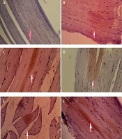 Phytochemical Characterization and Antidiabetic Evaluation of Saurauia bracteosa Leaf Extract in a Type 2 Diabetes Mellitus Model