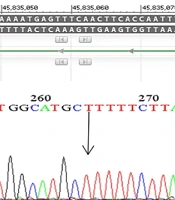 Oxidative Stress Influence and Some Gene SNPs of Leucine Zipper Transcription Factor Like 1 in Covid-19 Patients