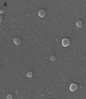 Comparative Pharmacokinetic Analysis of Albendazole Loaded in Solid Lipid Nanoparticles and Microemulsion in Hepatic and Pulmonary Tissues of Experimental Hydatidosis Murine Models