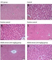 Evaluation of the Anti-obesity Effects of Alfalfa Aqueous Extract on a High-fat Diet-induced Obesity Model in Rats