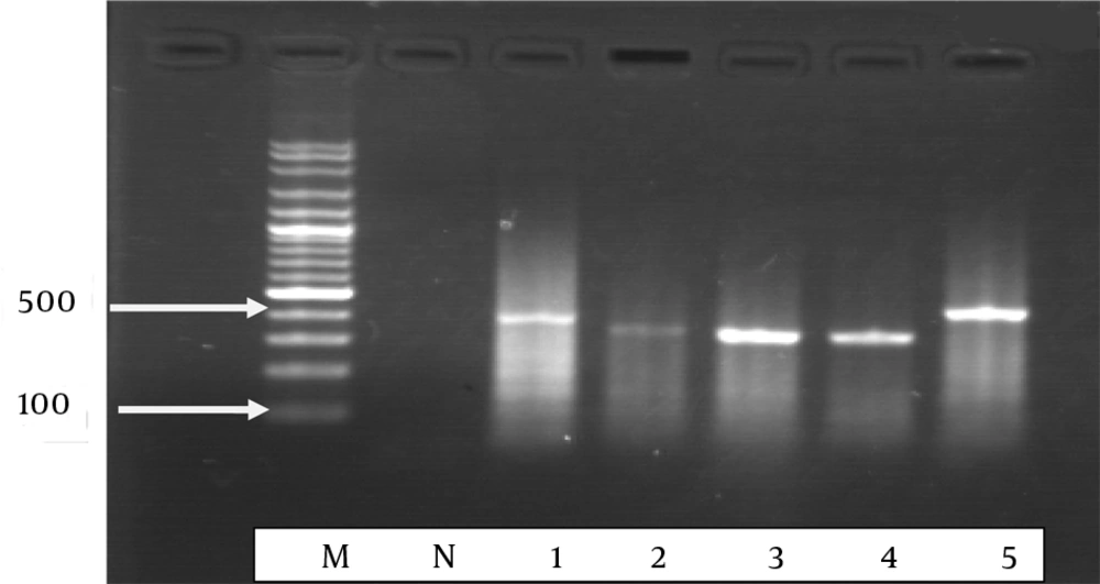 Semi-Nested PCR 1 Step results for <i>Candida</i> species, lane M: 100 bp molecular marker 100 and 500 bp rising order, lane N. negative control with water in place of template DNA. lane 1: <i>Candida albicans</i>, lane 2: <i>Candida tropicalis</i>, lane 3: <i>Candida parapsilosis</i>, lane 4 and 5: <i>Candida glabrata</i> with universal fungal primers, generating 350 to 410-bp fragments.