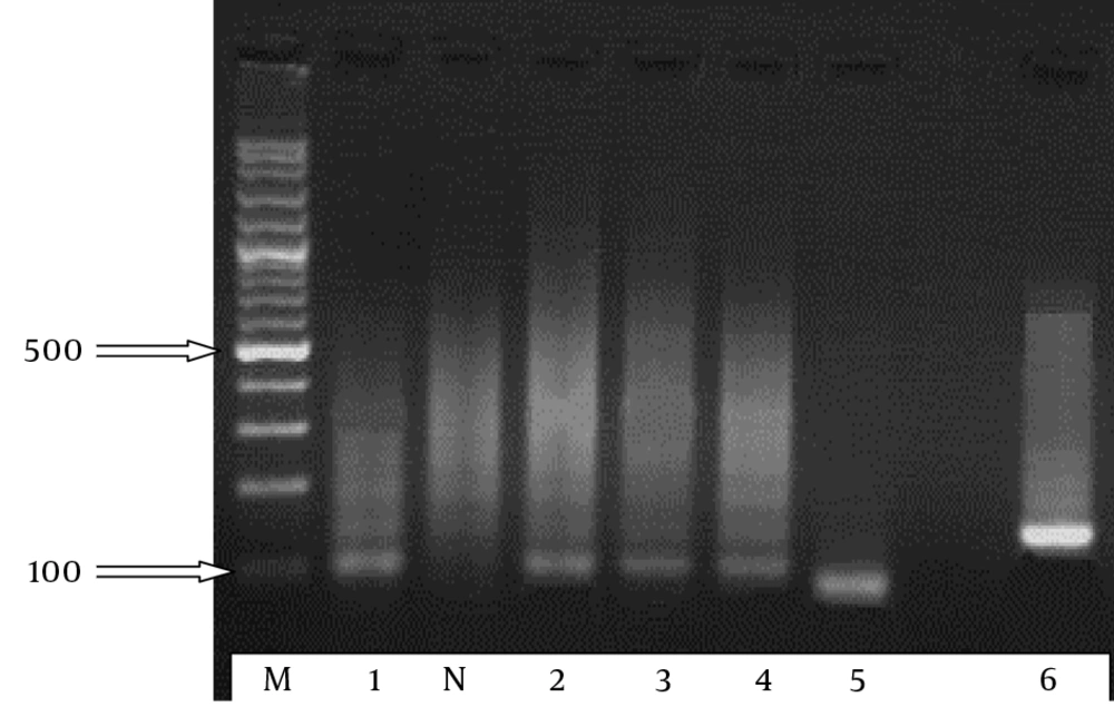 Semi-Nested PCR 2 Step results of the snPCR amplification of the DANs from <i>Candida albicans</i> (lane 1), <i>Candida tropicalis</i> (lanes 2 - 4), <i>Candida parapsilosis</i> (lane 5), and <i>Candida glabrata</i> (lane 6) using primer CTSR with primers CADET, CPDET, CTDET, and CGDET, respectively. lane M, 100-bp molecular size marker. Arrows indicate the positions of 100 and 500 bp rising order. 100 - 140 bp fragments.